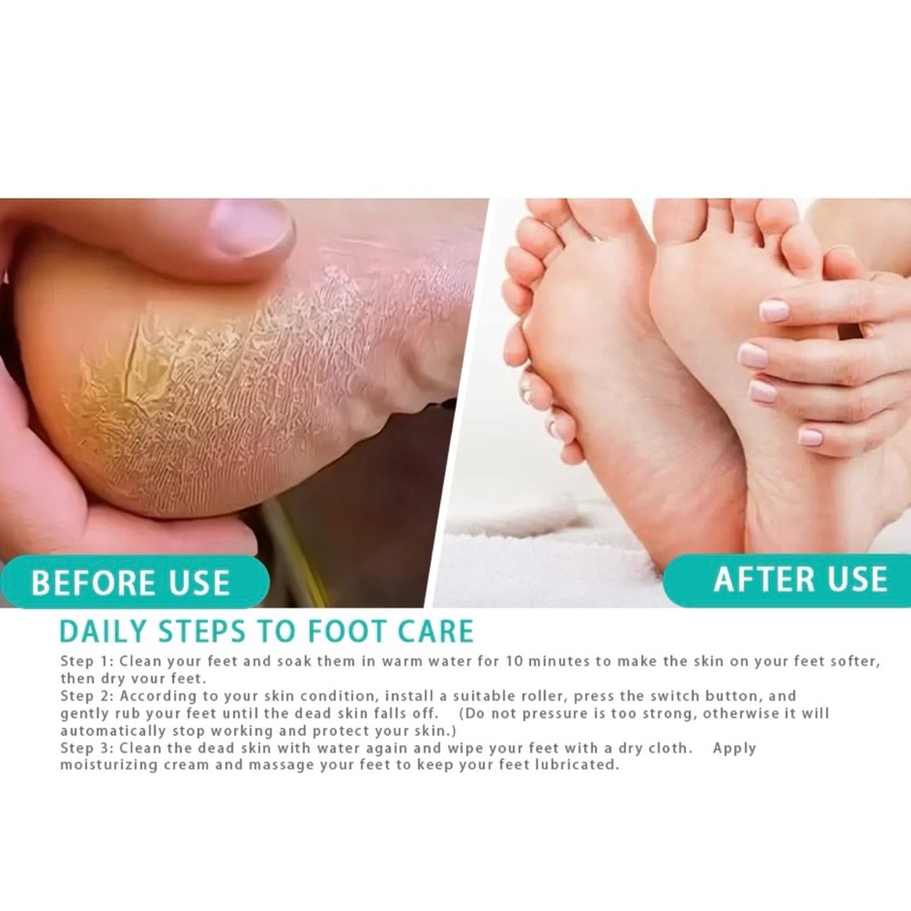 Electric Callus Remover - Picture 6 of 11